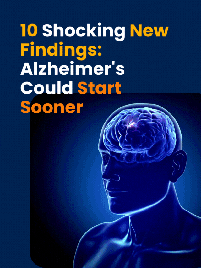 Alzheimer’s GIF